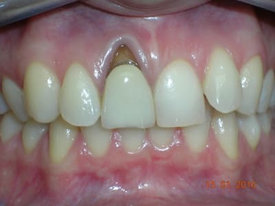 Dscn5231 tlb8kt - Eugenol