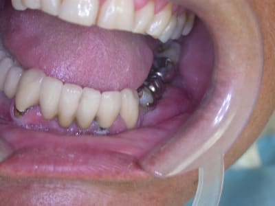 Dscn6766 luqjj0 - Eugenol