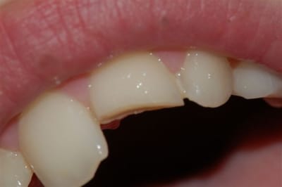 Dsc 0002  2  oxzi7f - Eugenol