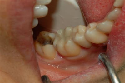 Dsc 0002 sentzv - Eugenol