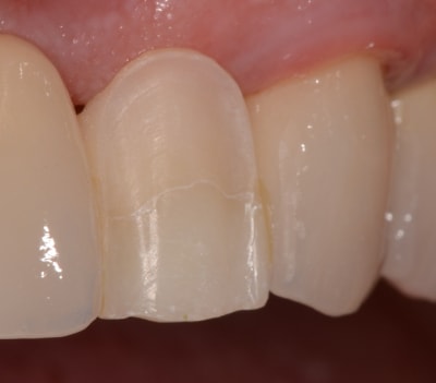 Dsc 0005 oq6wgr - Eugenol