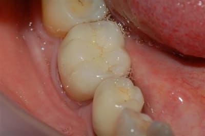 Dsc 0009 ohekvt - Eugenol