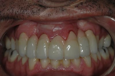 Dsc 0009 x6fojk - Eugenol