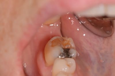 Dsc 0010 hzqs7c - Eugenol