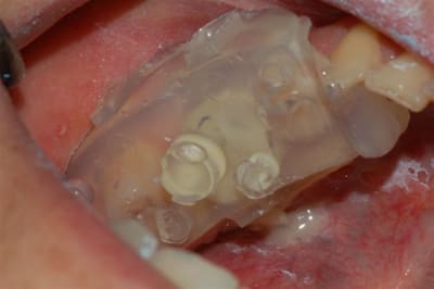 Dsc 0011 wzp6hw - Eugenol