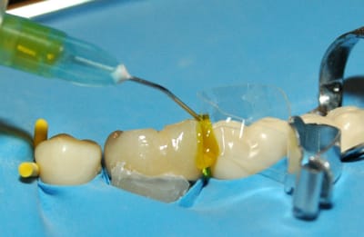 Dsc 0013 kwez0s - Eugenol