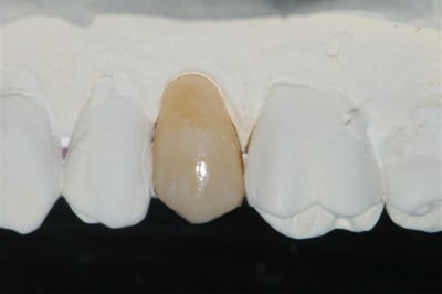 Dsc 0022 wxr985 - Eugenol