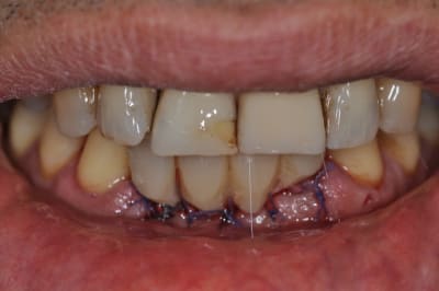 Dsc 0030 xv8oq1 - Eugenol