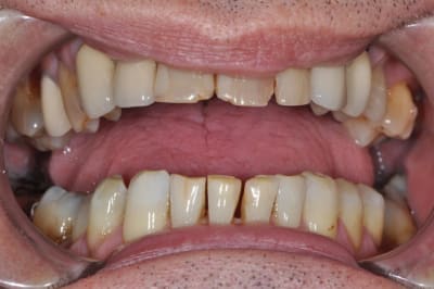 Dsc 0041 pgt5cr - Eugenol