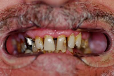 Dsc 0053 lbf6yf - Eugenol