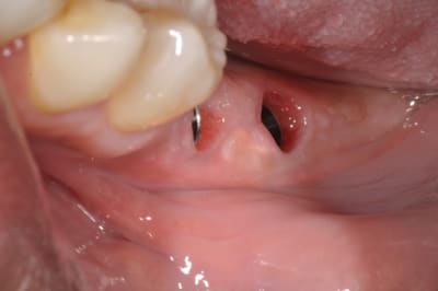 Dsc 0060 q9n6de - Eugenol
