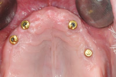 Dsc 0091 fjssjx - Eugenol