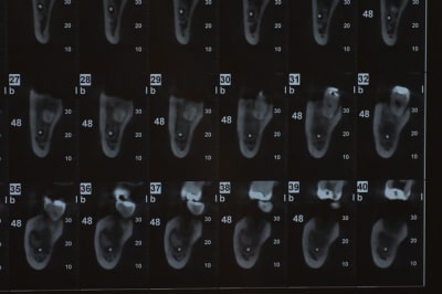 Dsc 0113 pufani - Eugenol