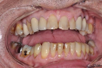 Dsc 0121 opew9a - Eugenol