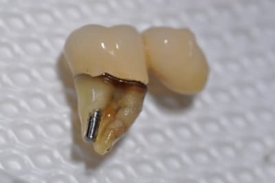 Dsc 0166 u4nto7 - Eugenol