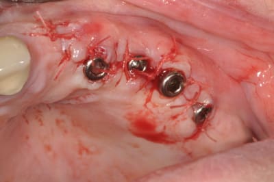 Dsc 0233 j4bbos - Eugenol