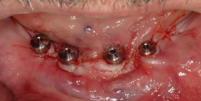 Dsc 0248 nwefmh - Eugenol