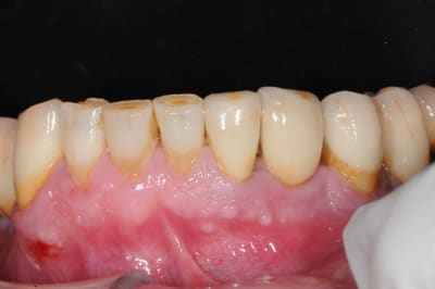 Dsc 0251 g2fnqo - Eugenol