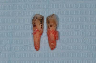 Dsc 0267 xvccwm - Eugenol