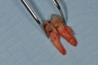 Dsc 0268 madh6v - Eugenol