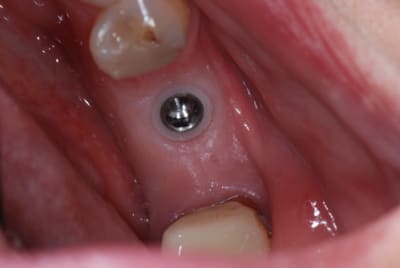 Dsc 0278 bjvsnz - Eugenol