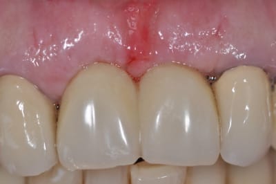 Dsc 0317 qrjaje - Eugenol