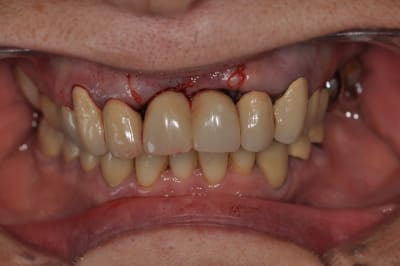 Dsc 0330 xjsth1 - Eugenol