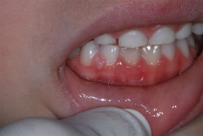 Dsc 0333 rid9yb - Eugenol