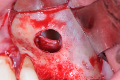 Dsc 0386 ihvyyt - Eugenol