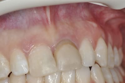 Dsc 0415 xl8stv - Eugenol