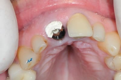 Dsc 0462 hieztd - Eugenol