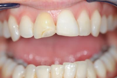 Dsc 0519 h2wmbe - Eugenol