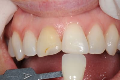 Dsc 0526 shty8c - Eugenol