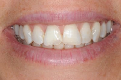 Dsc 0536 xfgl9d - Eugenol