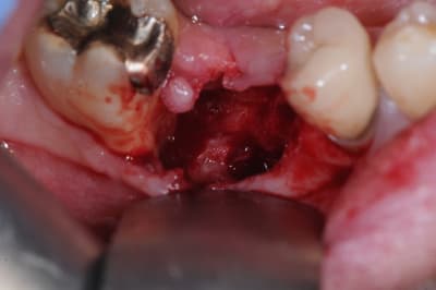 Dsc 0606 pjxdf7 - Eugenol