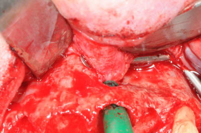 Dsc 0611 xpyuiz - Eugenol