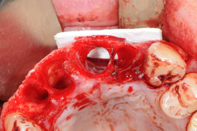 Dsc 0641 evr9xj - Eugenol