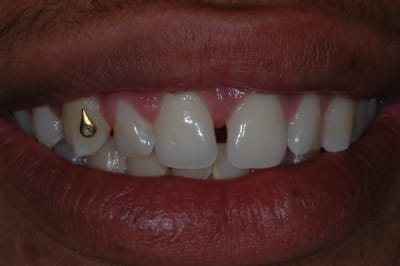 Dsc 0763 neoc0i - Eugenol