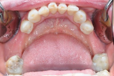 Dsc 1393 pm5zez - Eugenol