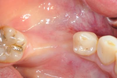 Dsc 1398 he7toc - Eugenol