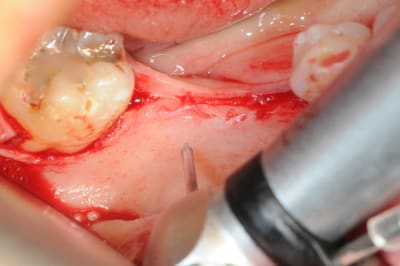 Dsc 1400 dzyhev - Eugenol