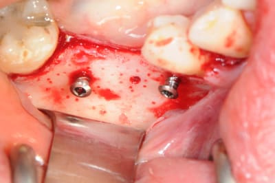 Dsc 1404 jrdi7k - Eugenol