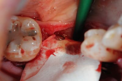 Dsc 1413 cyvkhn - Eugenol