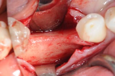 Dsc 1418 xoftci - Eugenol