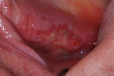 Dsc 1533 l8nsbw - Eugenol