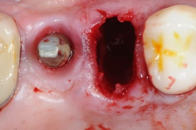 Dsc 1546 gim81q - Eugenol