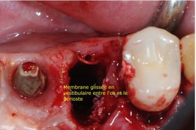 Dsc 155corrig 1 nhsjqu - Eugenol