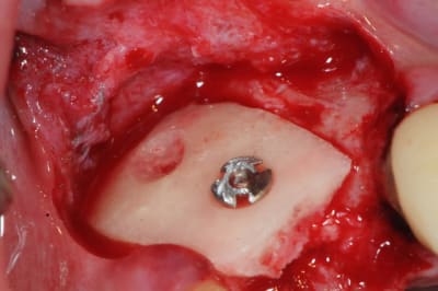 Dsc 1645 keqx3b - Eugenol