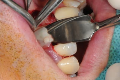 Dsc 1658 hx67td - Eugenol