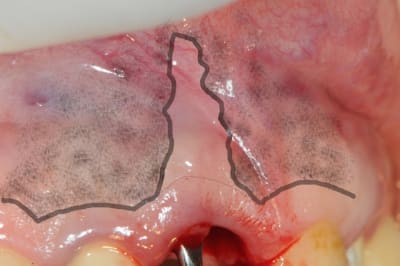 Dsc 1694  xijo71 - Eugenol